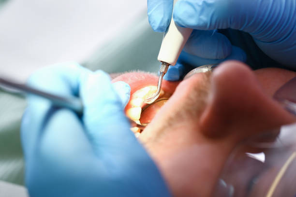 Best Mobile Emergency Dentist in USA